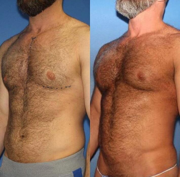 Images Gotham Plastic Surgery