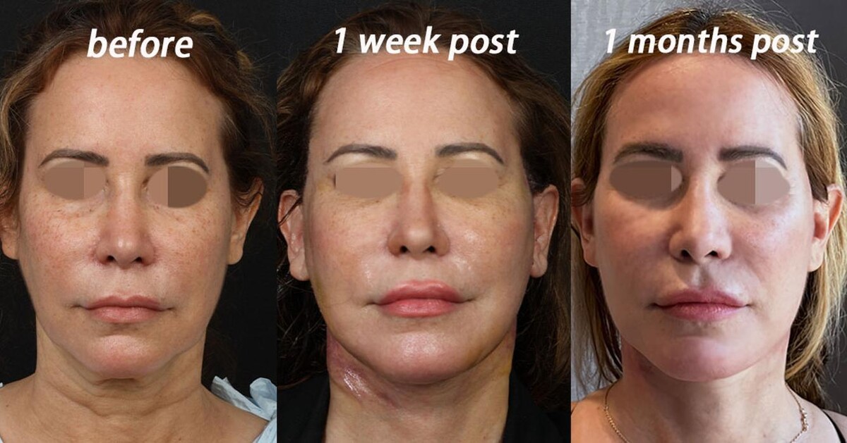 Images Gotham Plastic Surgery