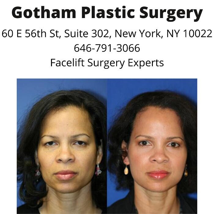 Images Gotham Plastic Surgery