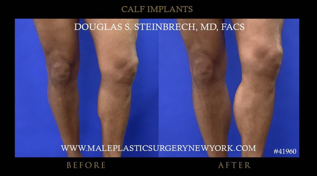 Images Gotham Plastic Surgery