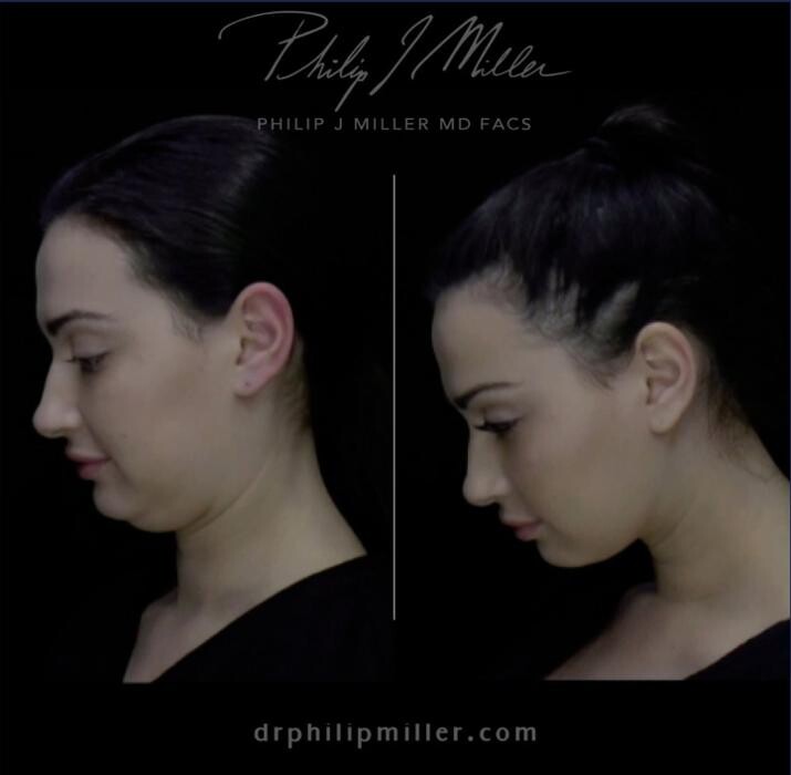 Images Gotham Plastic Surgery