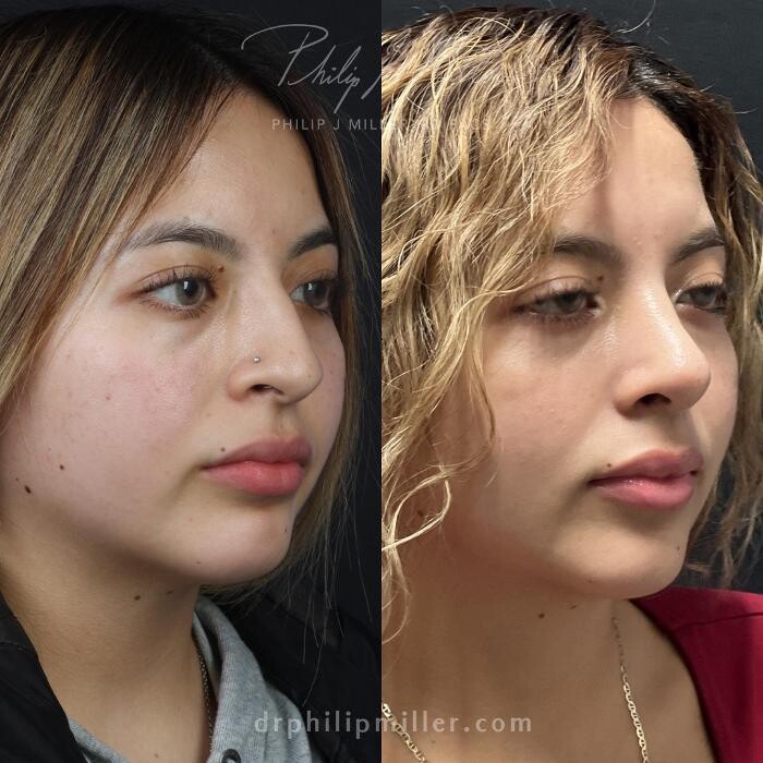 Images Gotham Plastic Surgery