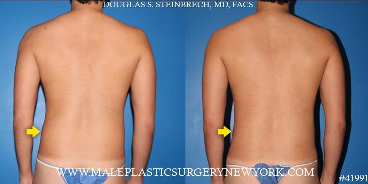 Images Gotham Plastic Surgery