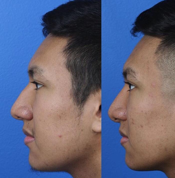 Images Gotham Plastic Surgery