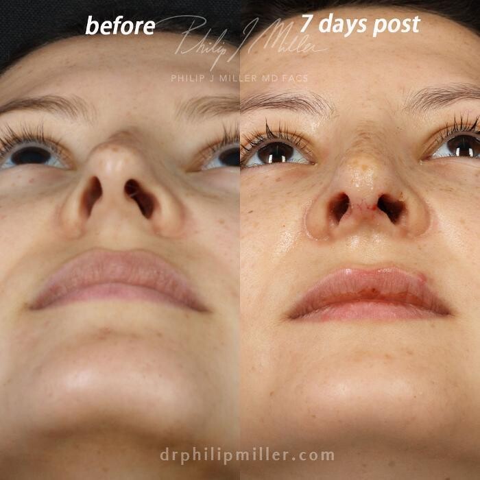 Images Gotham Plastic Surgery