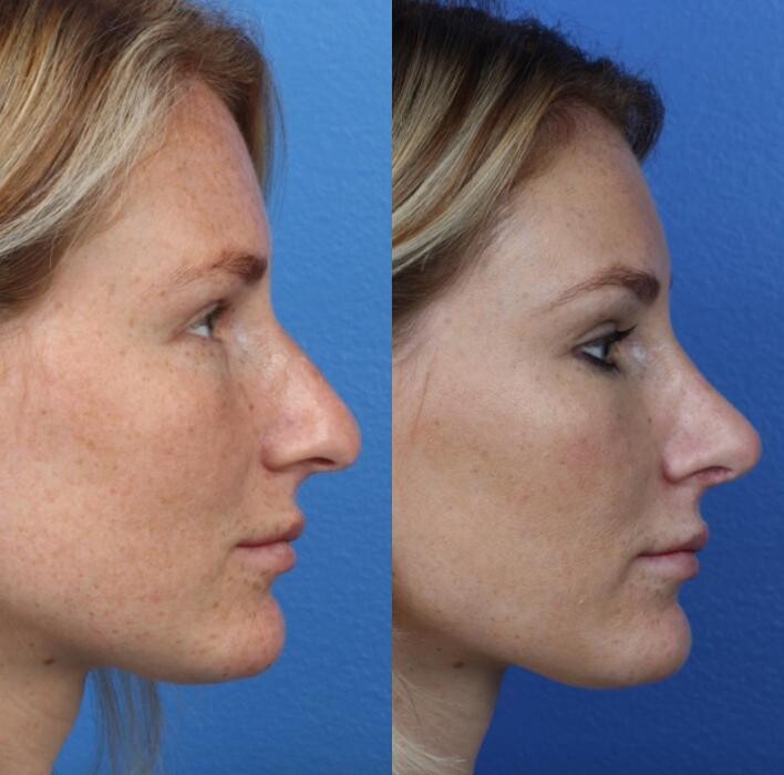 Images Gotham Plastic Surgery