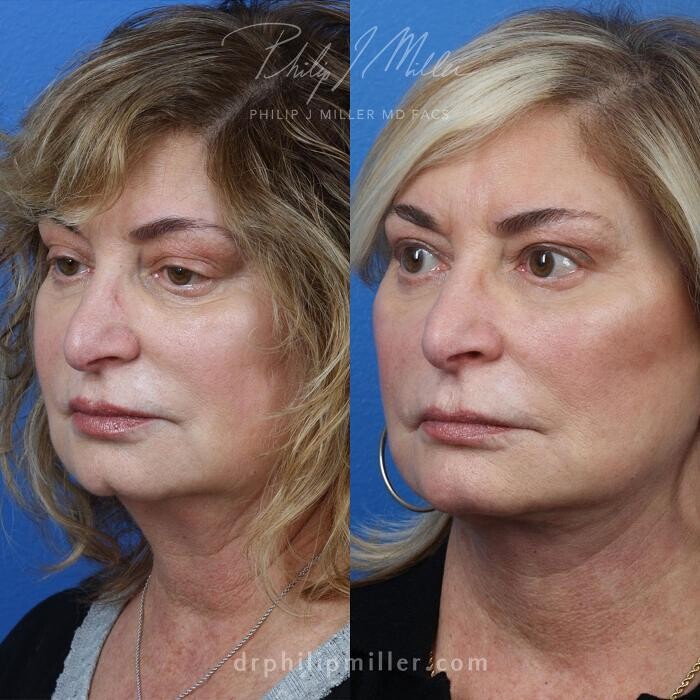 Images Gotham Plastic Surgery