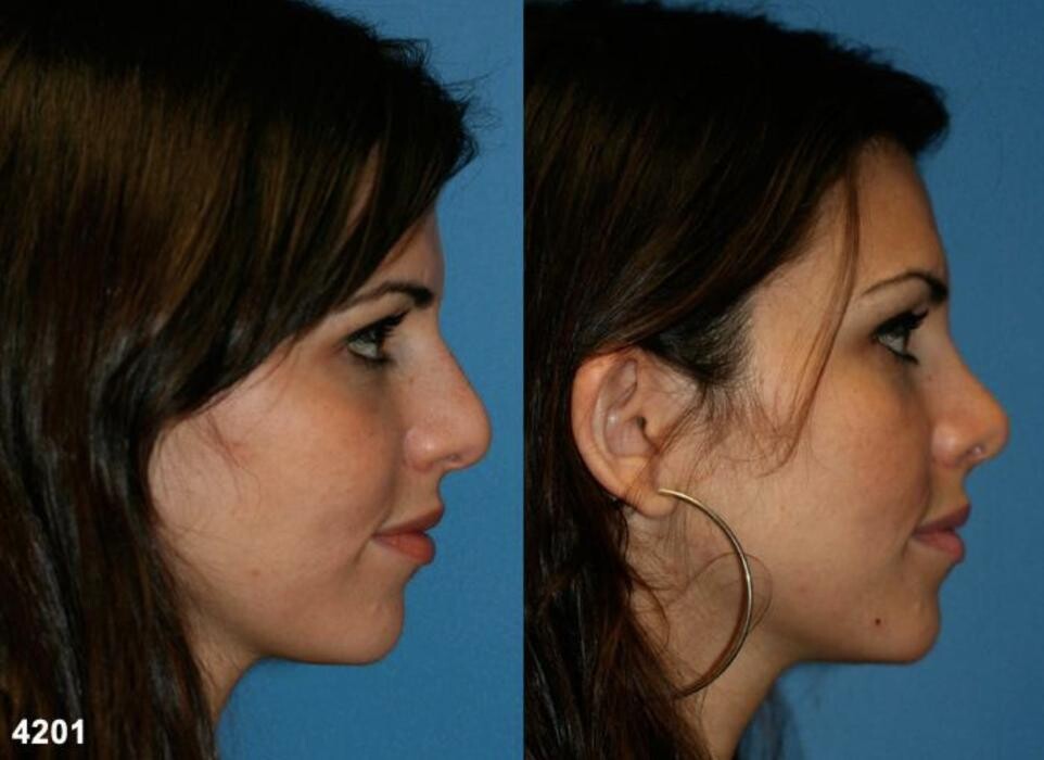 Images Gotham Plastic Surgery