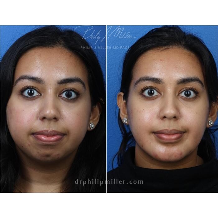 Images Gotham Plastic Surgery