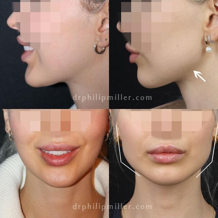 Images Gotham Plastic Surgery