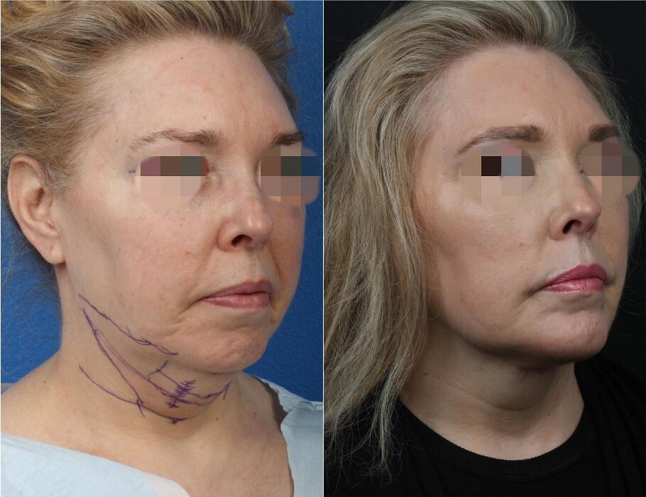 Images Gotham Plastic Surgery
