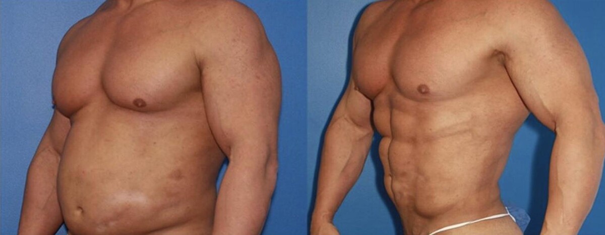 Images Gotham Plastic Surgery