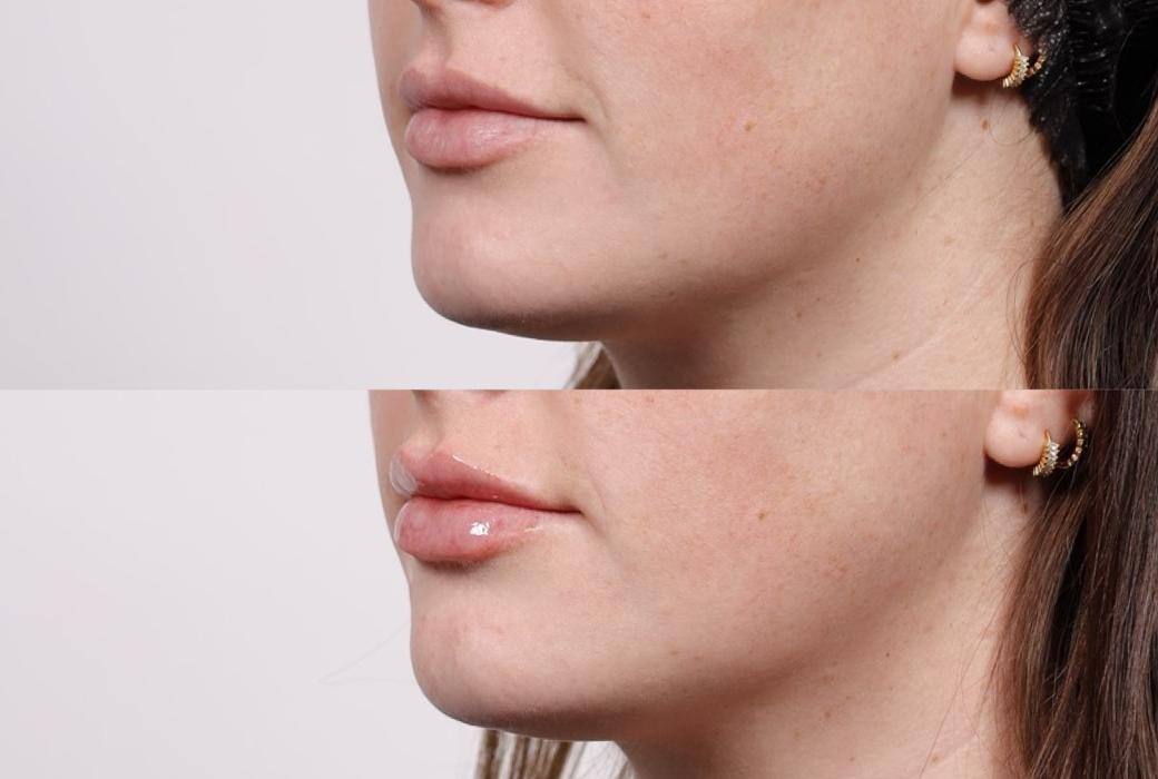 Images YOU Aesthetics