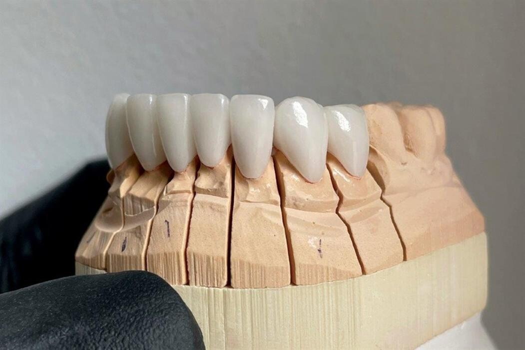 Images Park Slope Dental Aesthetics - Union Street