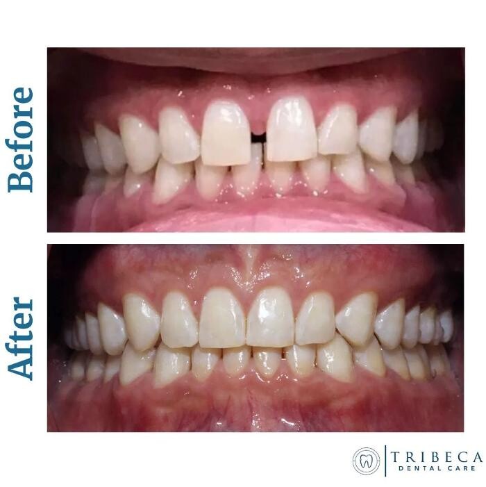 Images Tribeca Dental Care