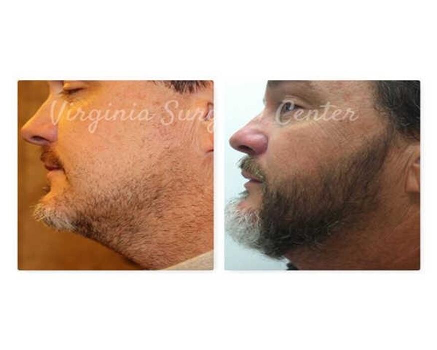 Images Virginia Surgical Center