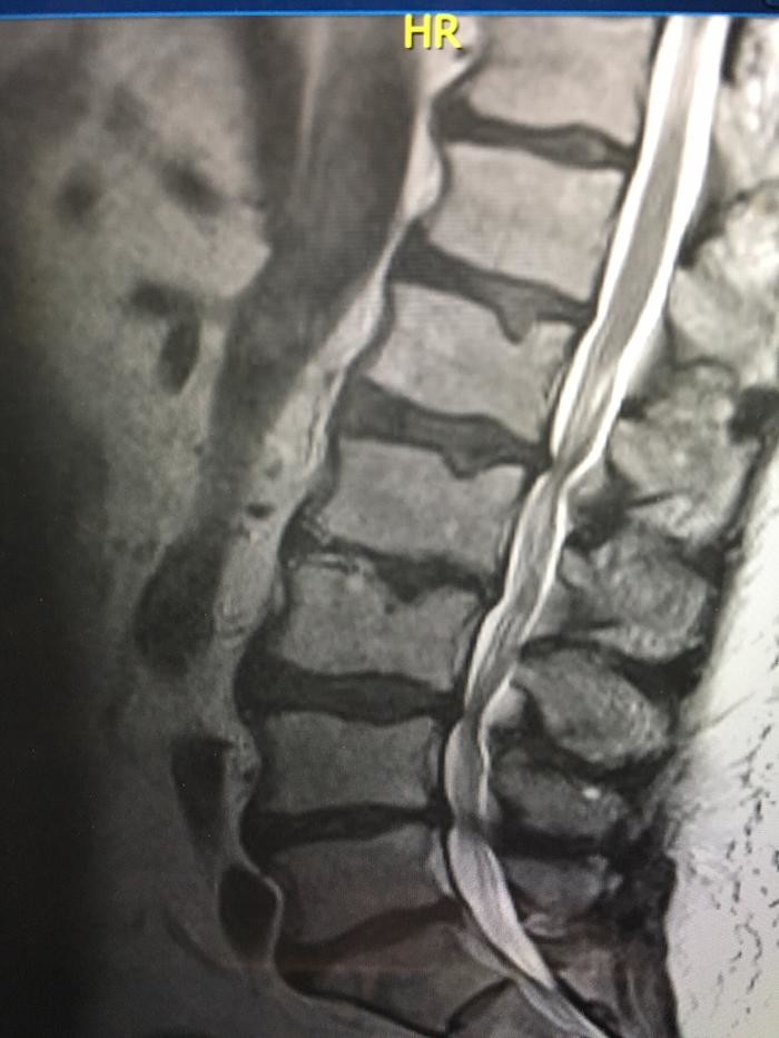 Images Interventional Pain Solutions