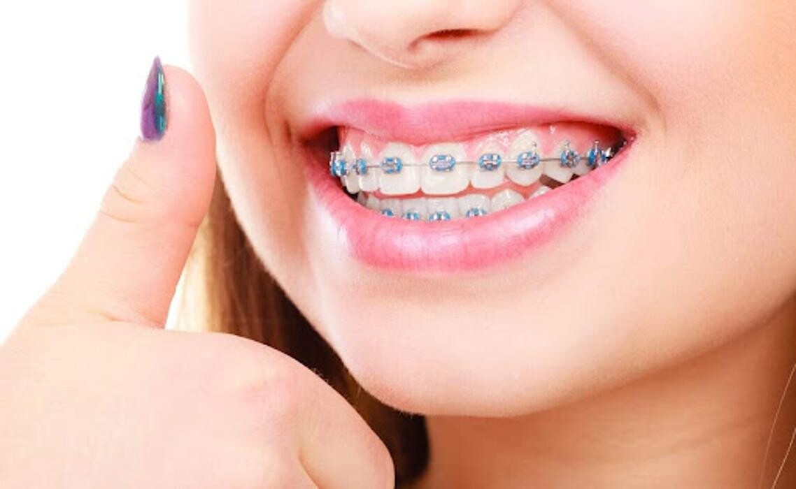 Images Buckeye Dental and Braces