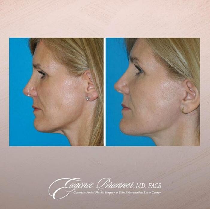 Images Eugenie Brunner, MD, FACS