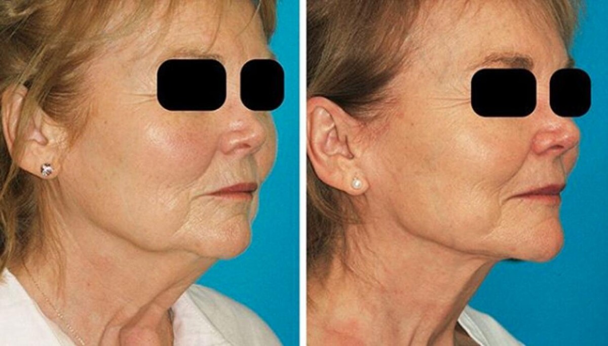 Images Eugenie Brunner, MD, FACS