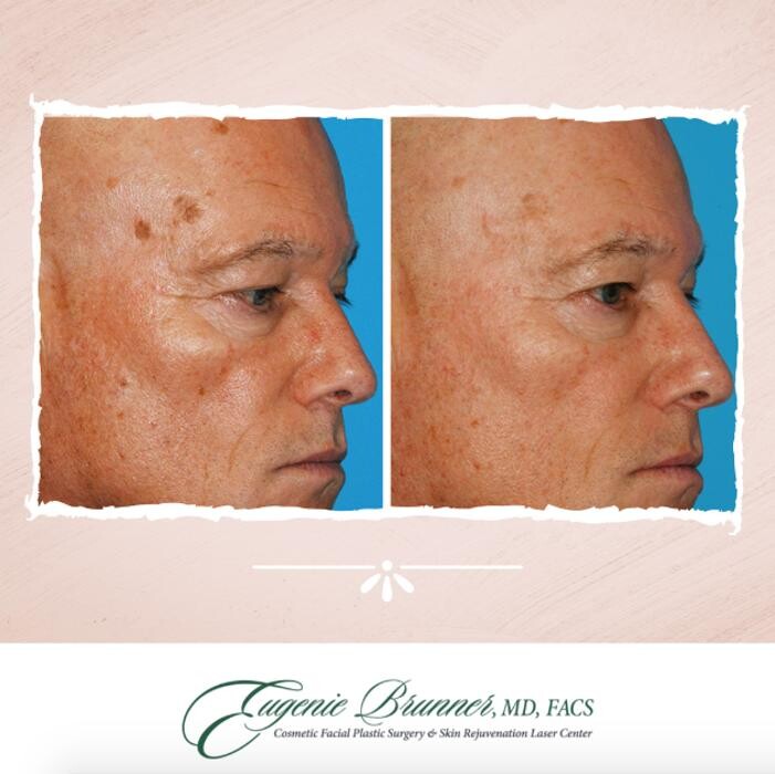 Images Eugenie Brunner, MD, FACS