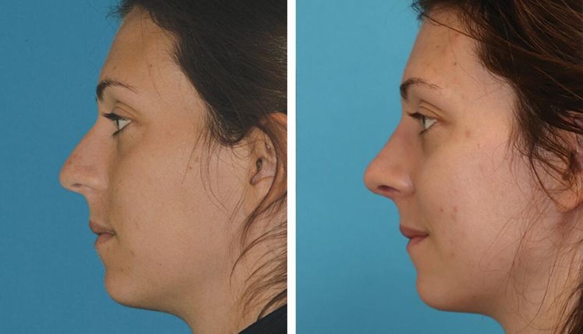 Images Eugenie Brunner, MD, FACS