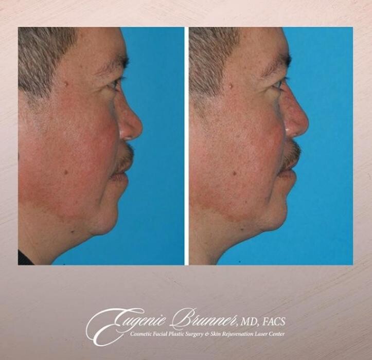 Images Eugenie Brunner, MD, FACS