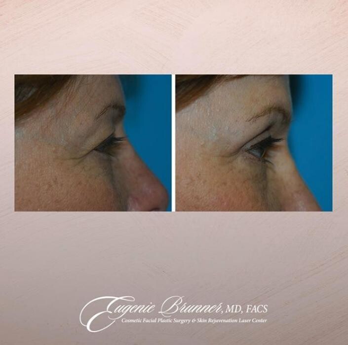 Images Eugenie Brunner, MD, FACS