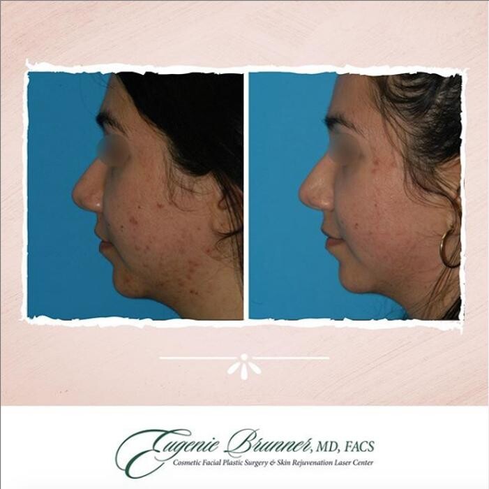 Images Eugenie Brunner, MD, FACS