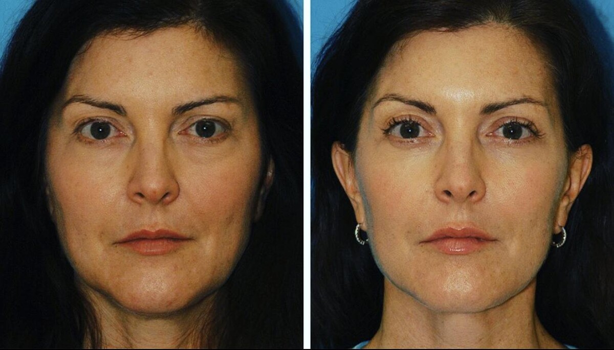 Images Eugenie Brunner, MD, FACS