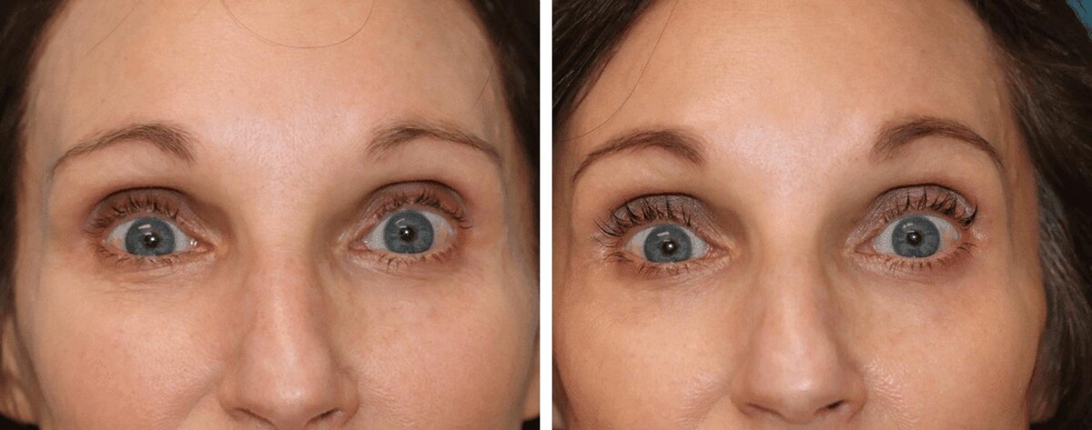 Images Eugenie Brunner, MD, FACS