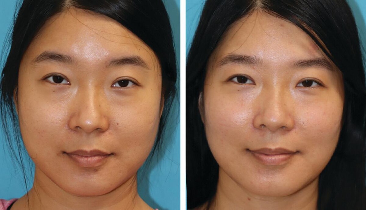 Images Eugenie Brunner, MD, FACS