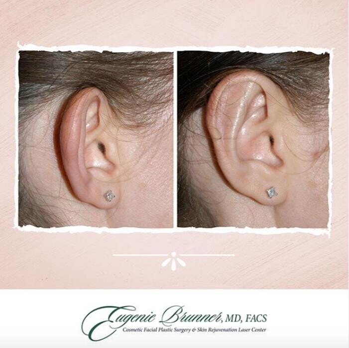 Images Eugenie Brunner, MD, FACS