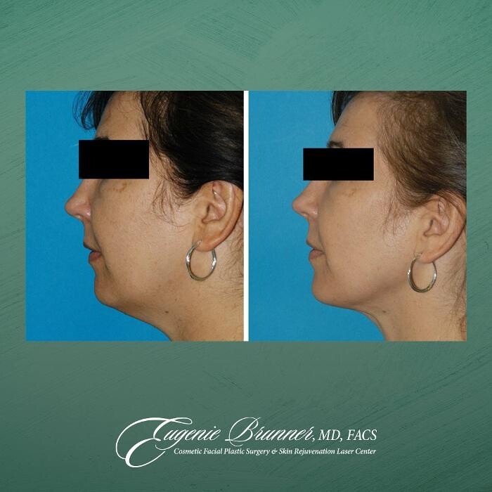 Images Eugenie Brunner, MD, FACS