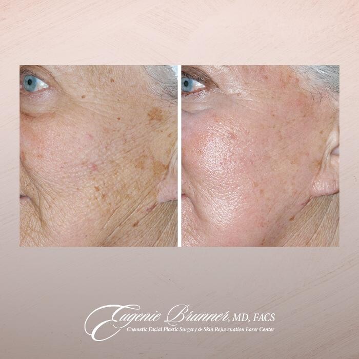 Images Eugenie Brunner, MD, FACS