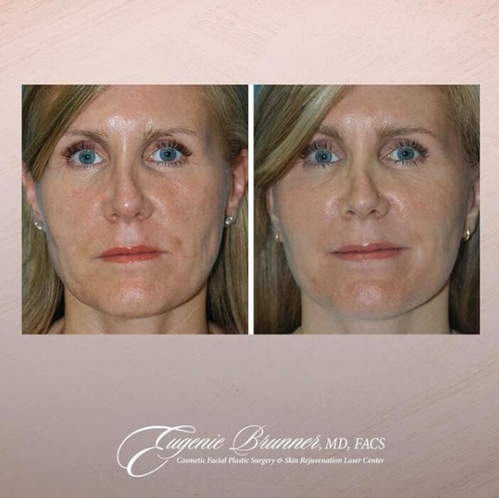 Images Eugenie Brunner, MD, FACS