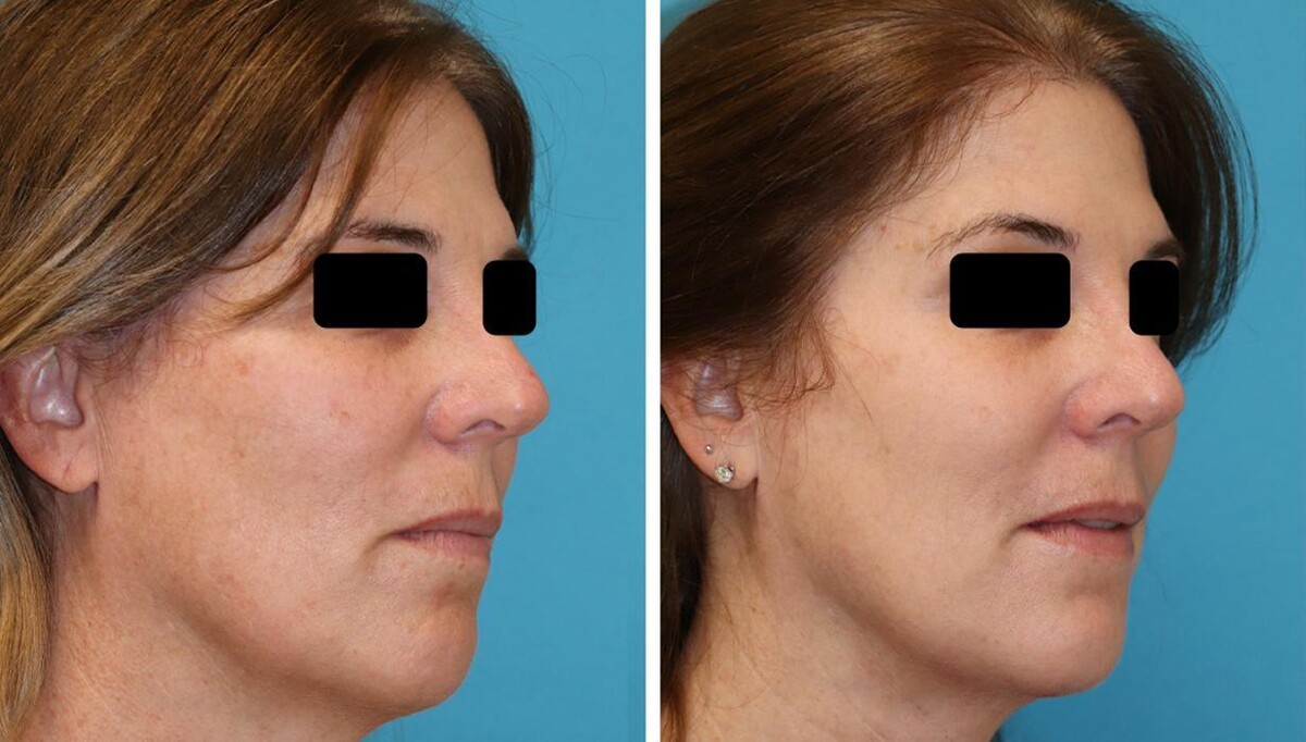 Images Eugenie Brunner, MD, FACS