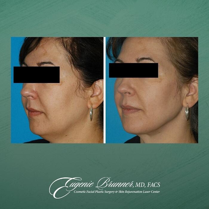 Images Eugenie Brunner, MD, FACS