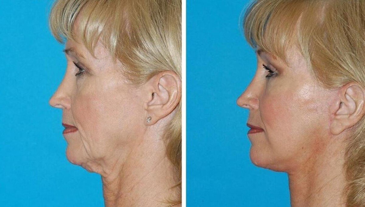 Images Eugenie Brunner, MD, FACS