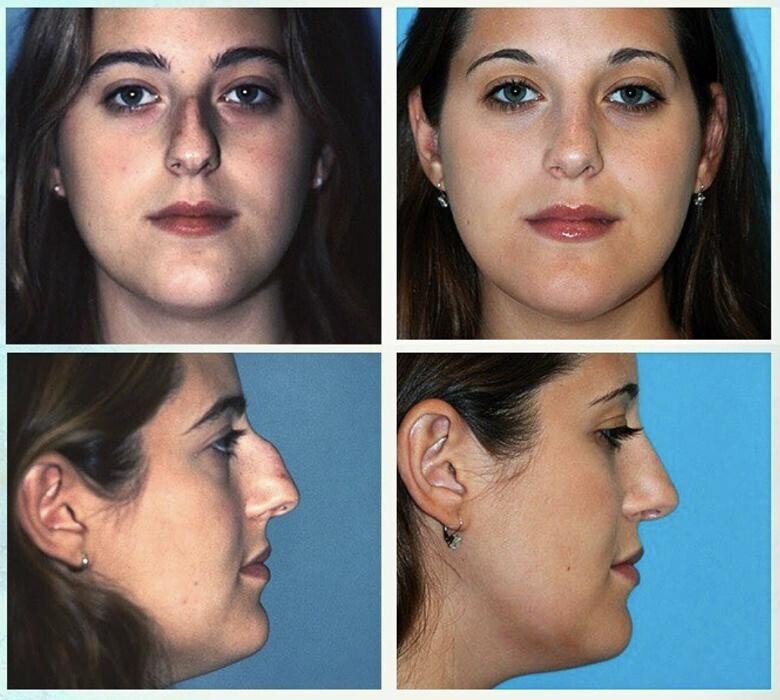 Images Eugenie Brunner, MD, FACS