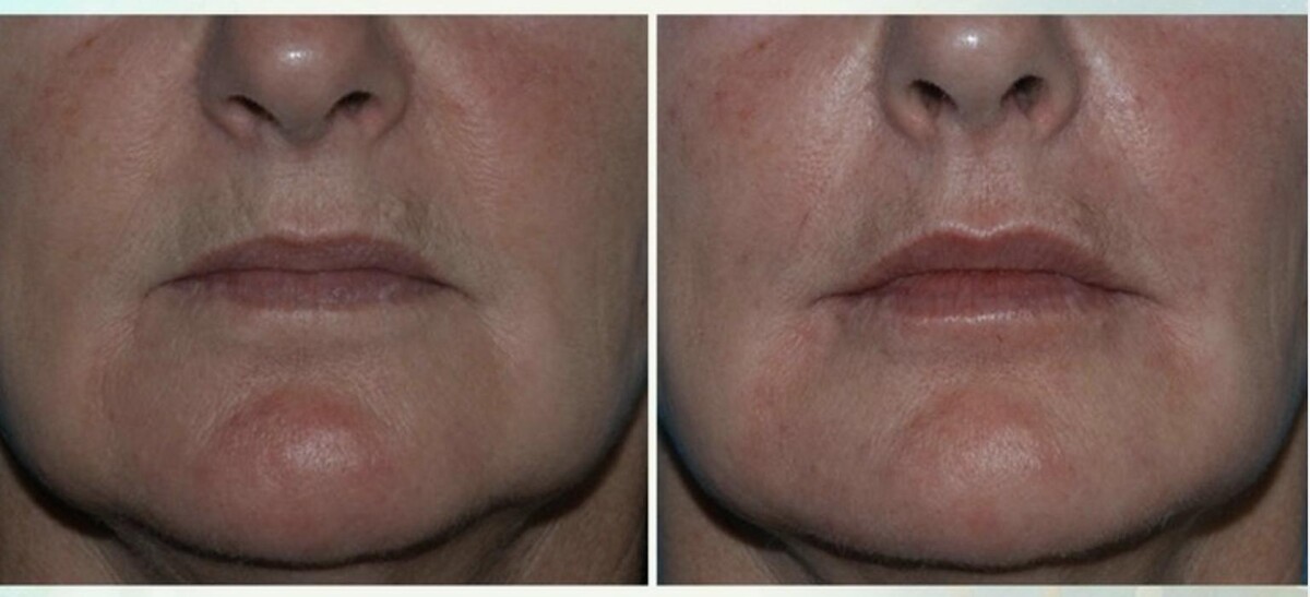 Images Eugenie Brunner, MD, FACS