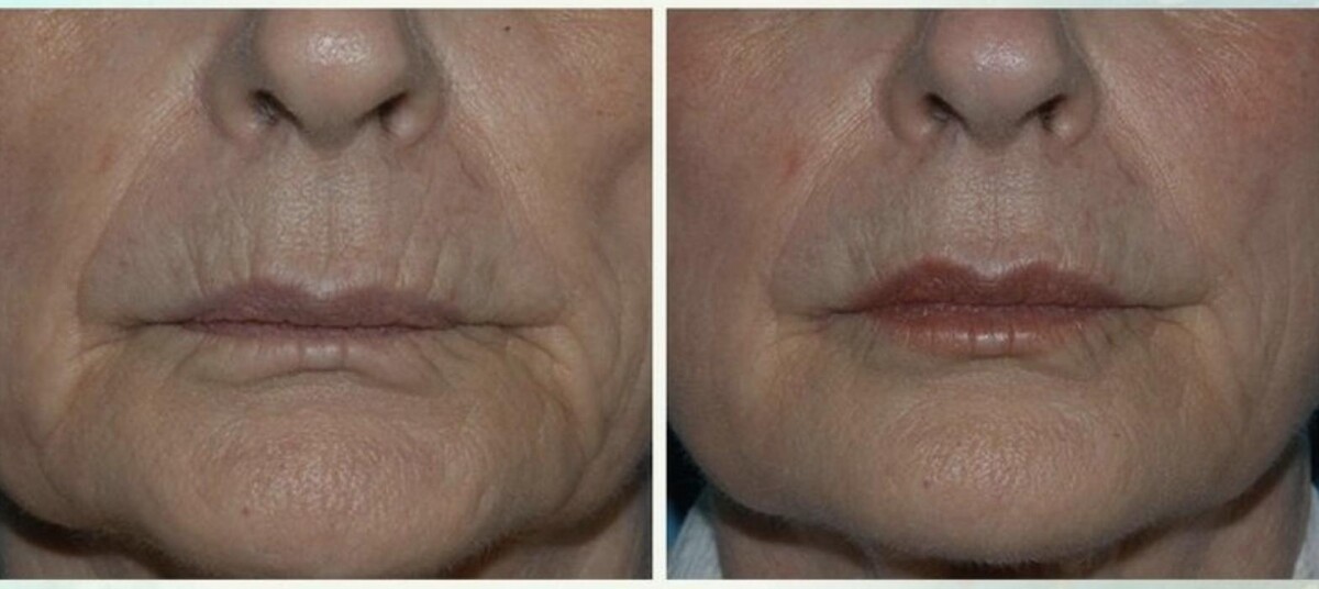 Images Eugenie Brunner, MD, FACS