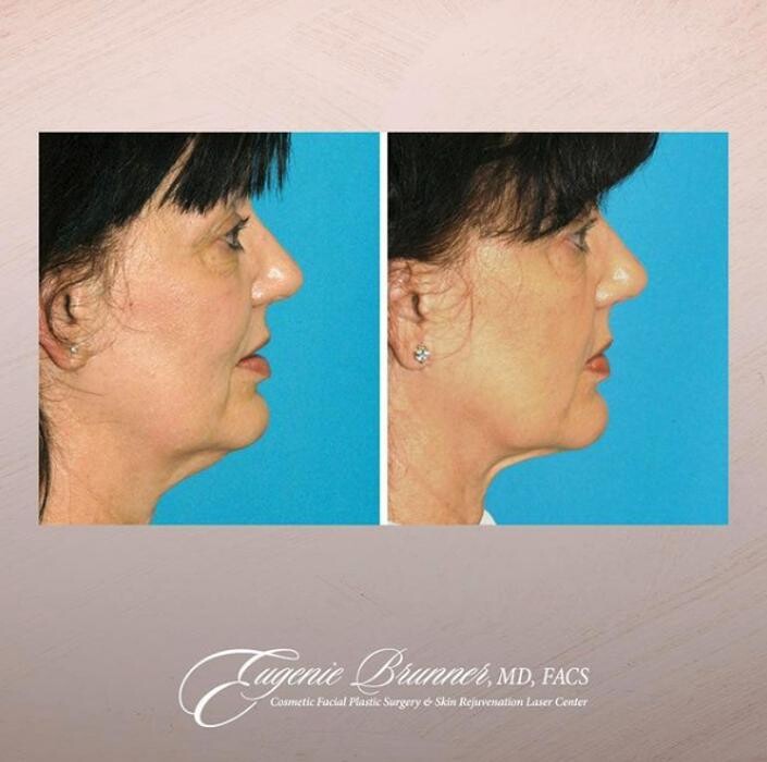 Images Eugenie Brunner, MD, FACS