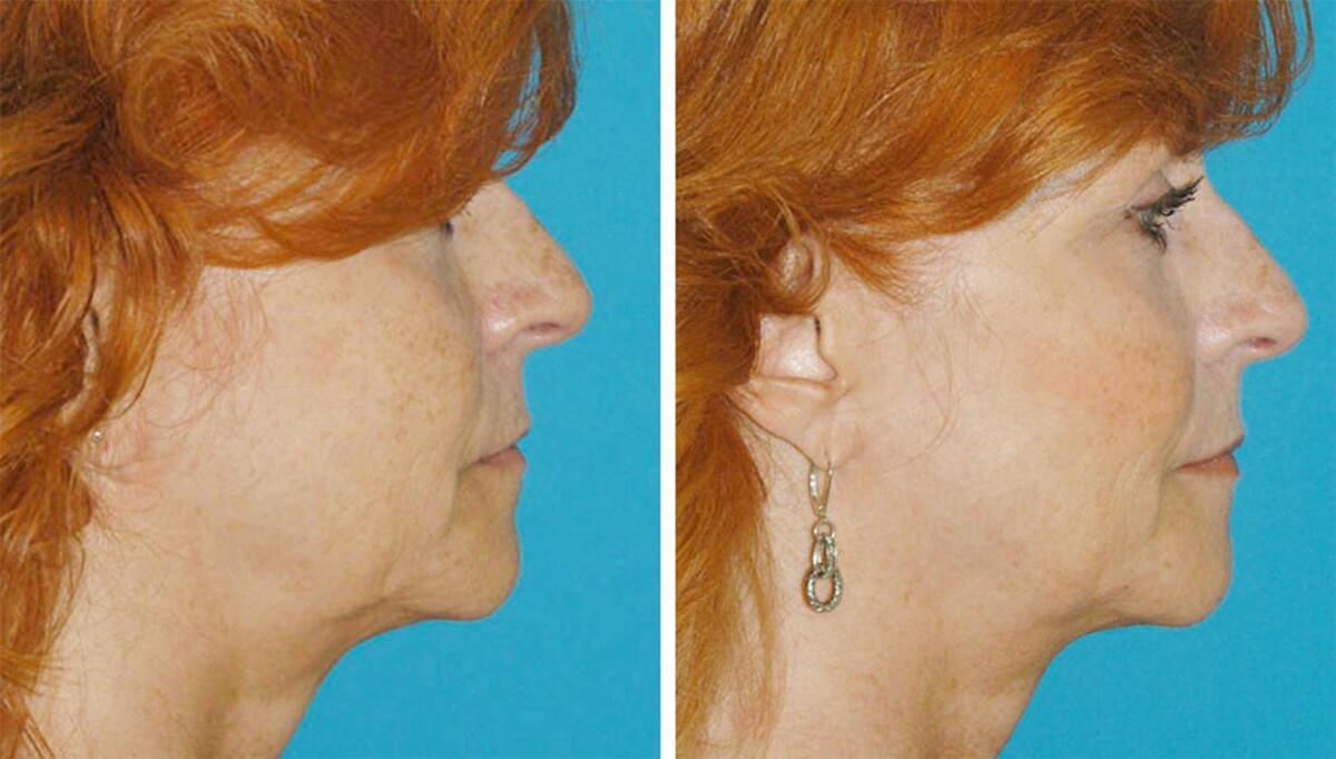 Images Eugenie Brunner, MD, FACS