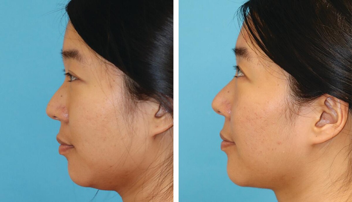 Images Eugenie Brunner, MD, FACS