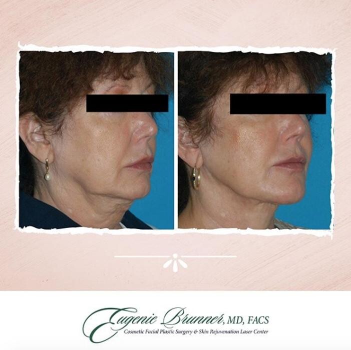 Images Eugenie Brunner, MD, FACS