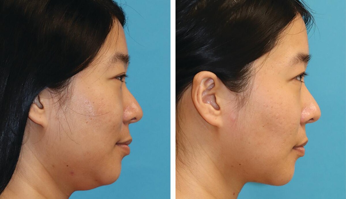 Images Eugenie Brunner, MD, FACS