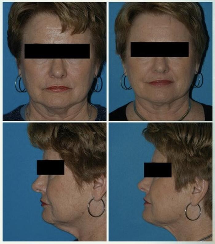 Images Eugenie Brunner, MD, FACS