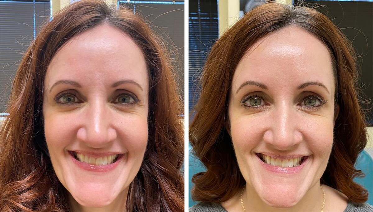 Images Eugenie Brunner, MD, FACS