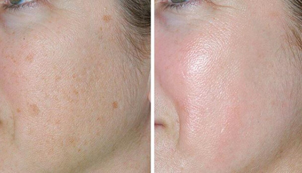 Images Eugenie Brunner, MD, FACS